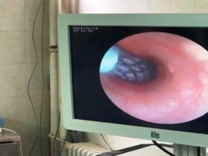 Türkiye’de İlk Kez Bir Köpeğe Stent Takıldı