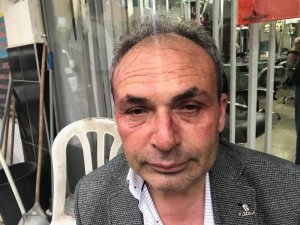 Chp’li Belediye Başkan Yardımcısına Saldırı Anı Güvenlik Kamerasında