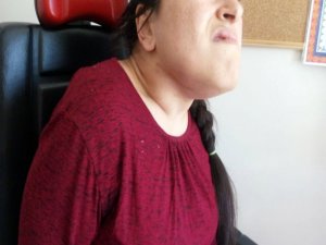 26 Yaşındaki Engelli Hastanın Çenesinin Altından 38 Cm Büyüklüğünde Tümör Çıkarıldı