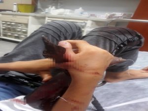 Eline Korkuluk Demiri Saplandı