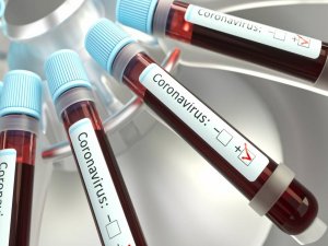 Diyabet İlacı Koronavirüse Bağlı Ölümleri Önlüyor