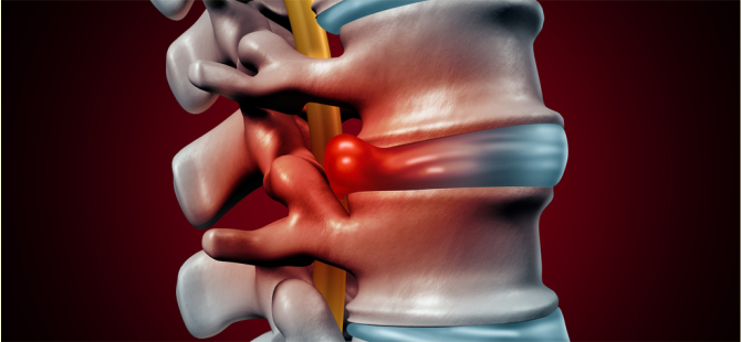 Bel ve boyun ağrısı şikayetleri her geçen gün artıyor!