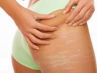 Çatlaklarınız Da Bronzlaşsın!