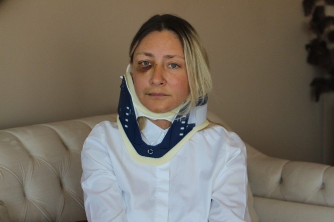 Kuşadası’nda Saldırıya Uğrayan Kadın Banka Müdürü Konuştu